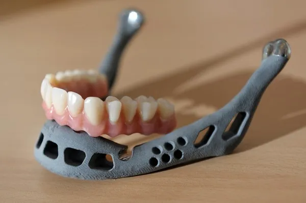 Напечатанная на 3D-принтере вставная челюсть
