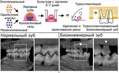 Техника выращивания биоинженерного зуба